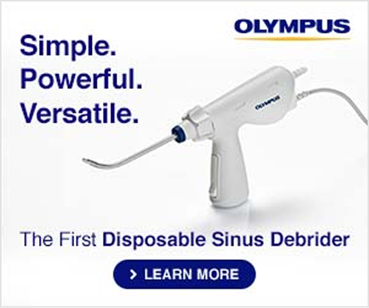 Banner Ad before design system