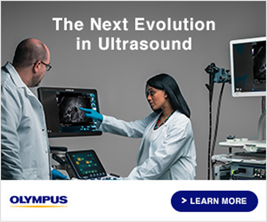 Banner Ad before design system