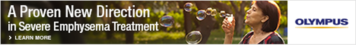 Banner Ad before design system